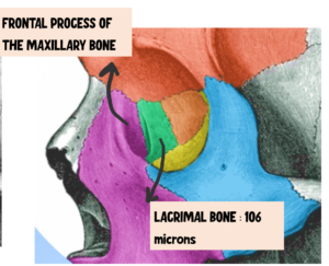 bones forming lacrimal fossa