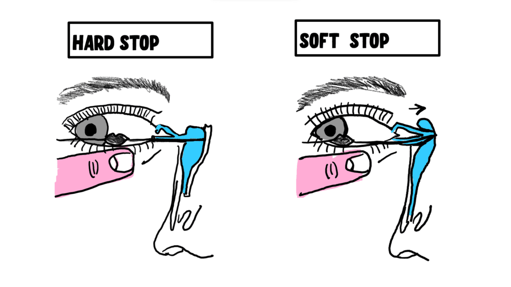 lacrimal syringing , the image shows a hard stop and a soft stop