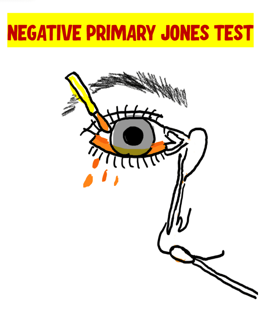 negative jones test 1