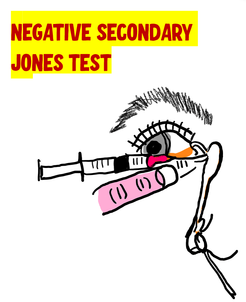 negative secondary jones test