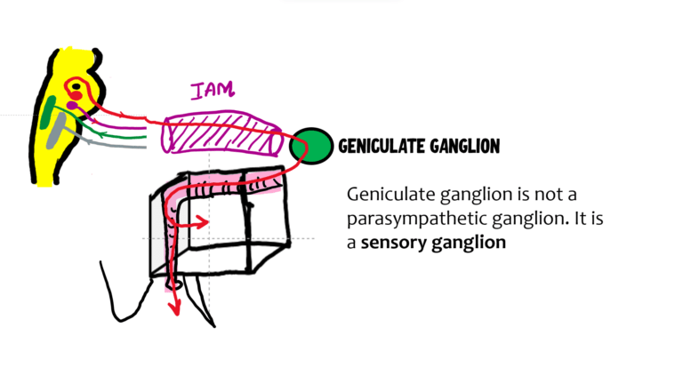 schematic diagram showing entry of facial nerve into internal acoustic meatus and into middle ear, finally reaching the geniculate ganglion