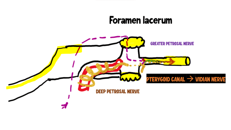 image showing greater petrosal nerve, deep petrosal nerve and vidian nerve .