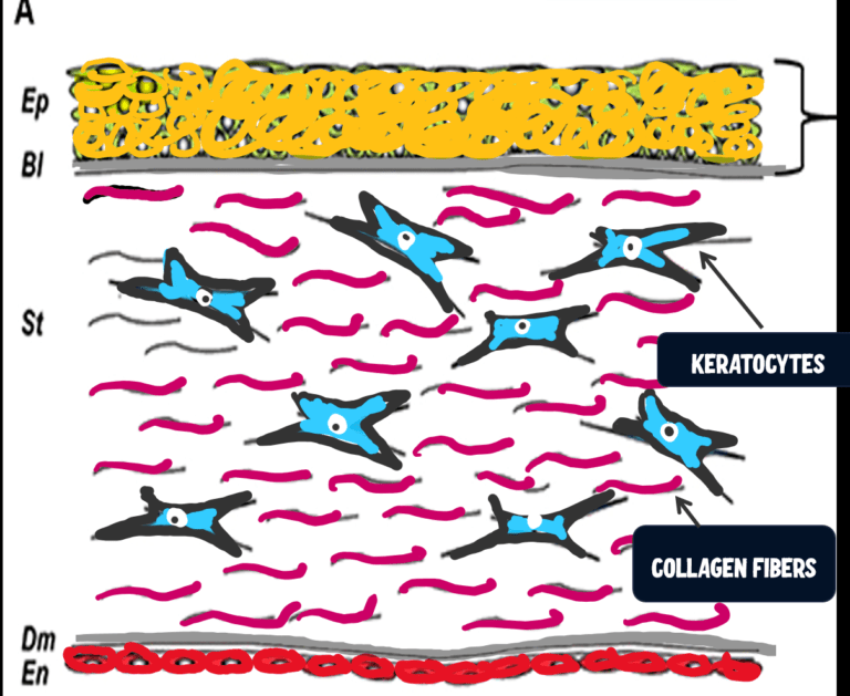 image depicting the composition of the corneal stroma: keratocytes with collagen fibrils