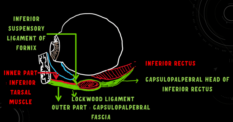 image showing lower lid reatractors, lockwood ligament and capsulopalpebral fascia