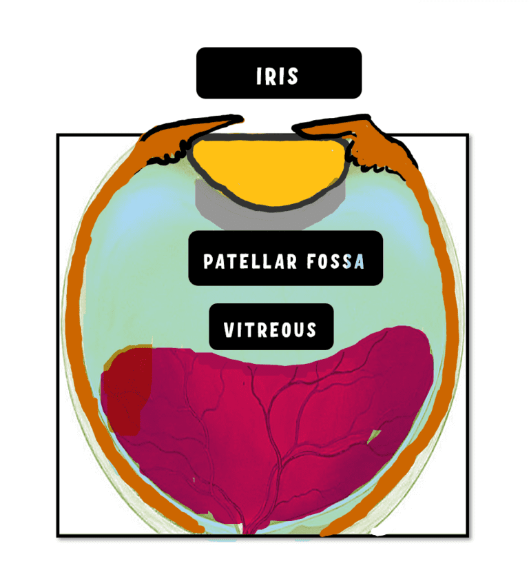 image showing the human crystalline lens location between the iris and the vitreous. It is placed inside the patellar fossa