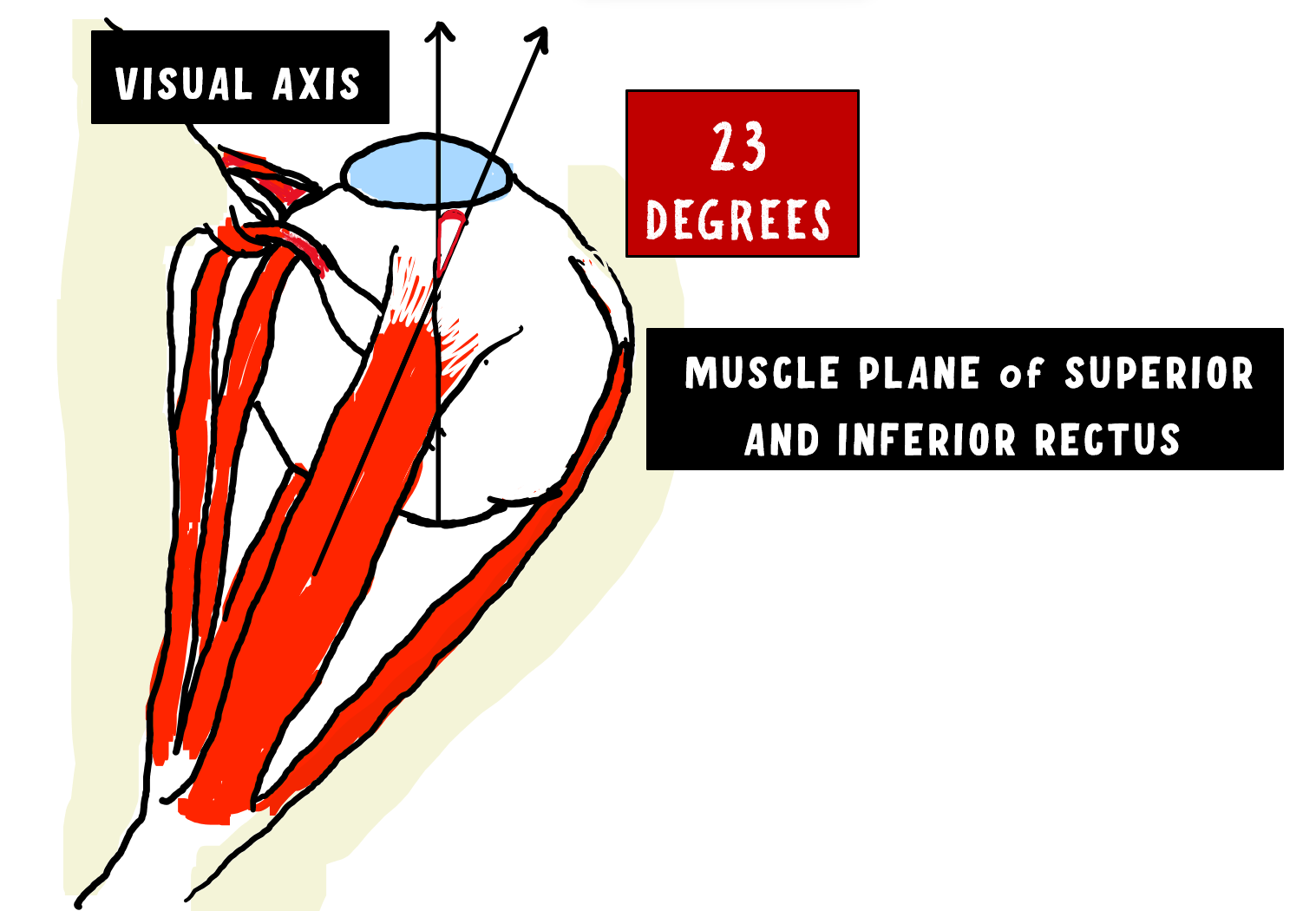 Anatomy Of Extraocular Muscles (EOM): Comprehensive Guide - INSIGHT ...