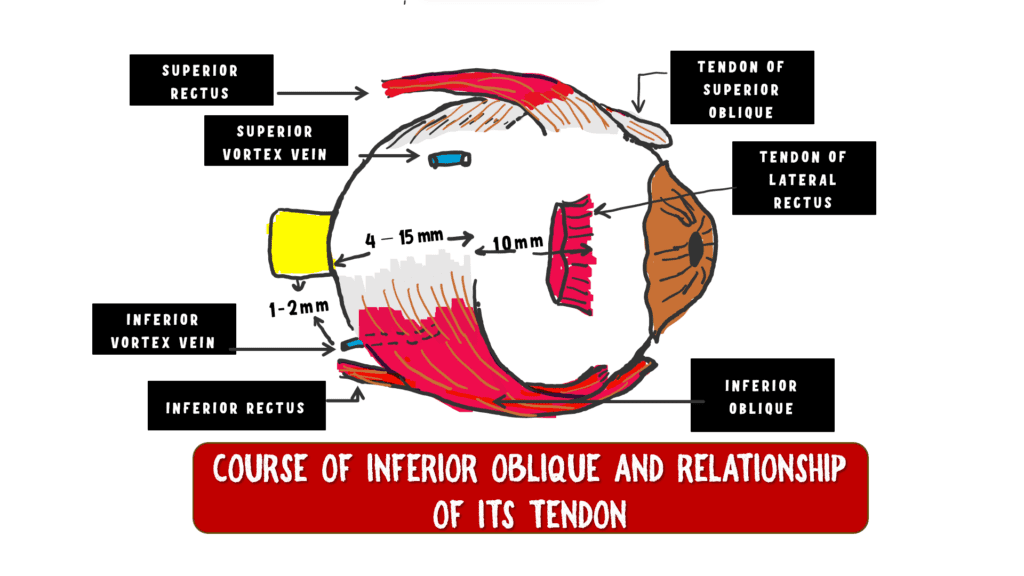 image depicting the course of inferior oblique and insertion of its tendon