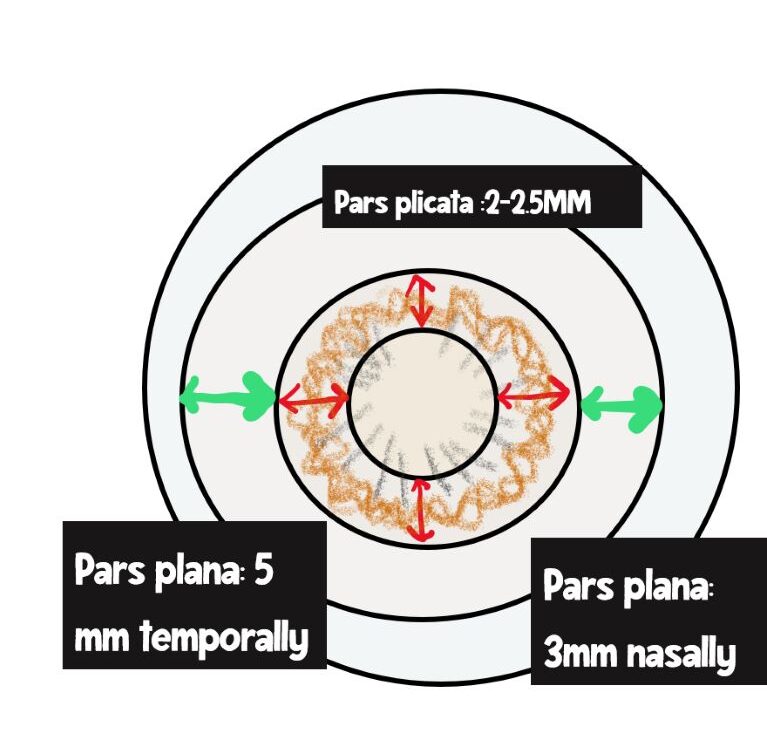 image showing important dimensions of the ciliary body