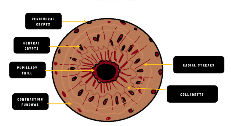 Anatomy of anterior surface of iris; crypts, radial streaks and contraction furrows