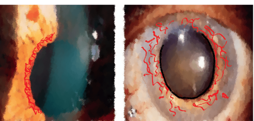 Anatomy of Iris :Topography and layers of Iris - INSIGHT OPHTHALMOLOGY