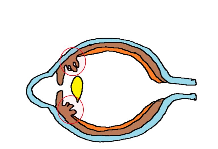 diagram depicting the location of ciliary body as a middle part of the uveal tract