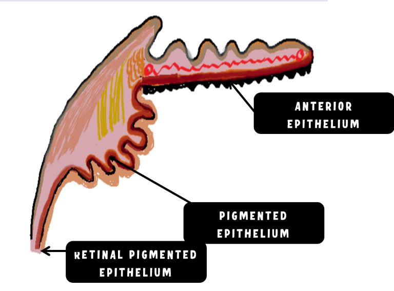 image showing anterior continuation of the pigmented epithelium of the ciliary body as the anterior epithelium of the iris and posterior continuation as retinal pigment epithelium