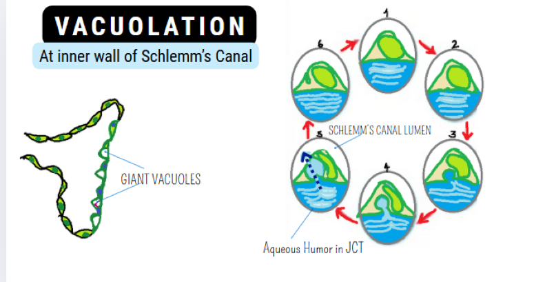 Diagram showing dome-shaped endothelial infoldings—giant vacuoles—transferring aqueous humor from juxtacanalicular trabecular meshwork into Schlemm’s canal lumen, represented in stepwise cycles from 1 to 6. Juxtacanalicular meshwork is shown in blue.