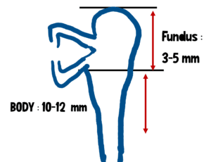 parts of lacrimal sac