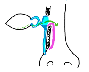 dacryocystorhinostomy