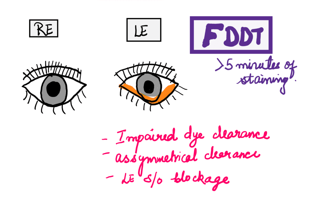 FDDT test