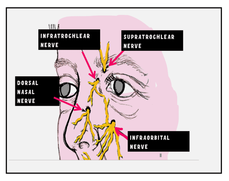 local aneasthesia for lacrimal sac surgeries