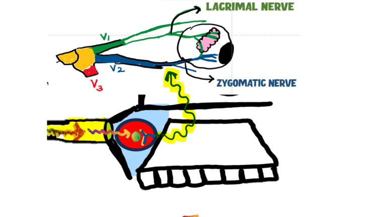 image showing sphenopalatine ganglion/ pterygopalatine ganglion