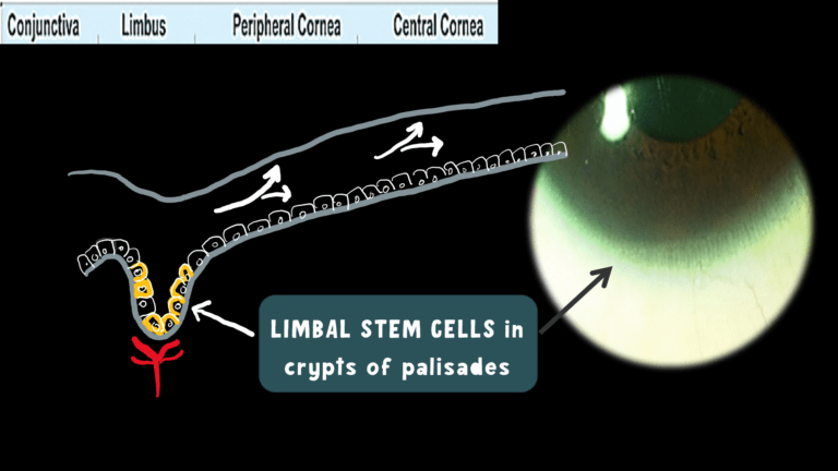 image depicting th location of stem cells of cornea in palisades of vogt in limbus