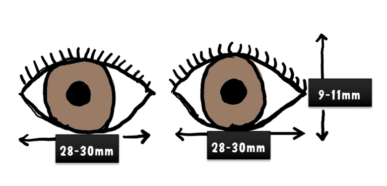 iamge showing normal palpebral fissure height and width