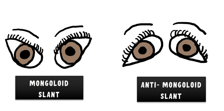 image showing mongoloid and antimongoloid slant