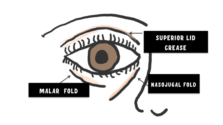 IMAGE depicts the lid creases and folds of the lids