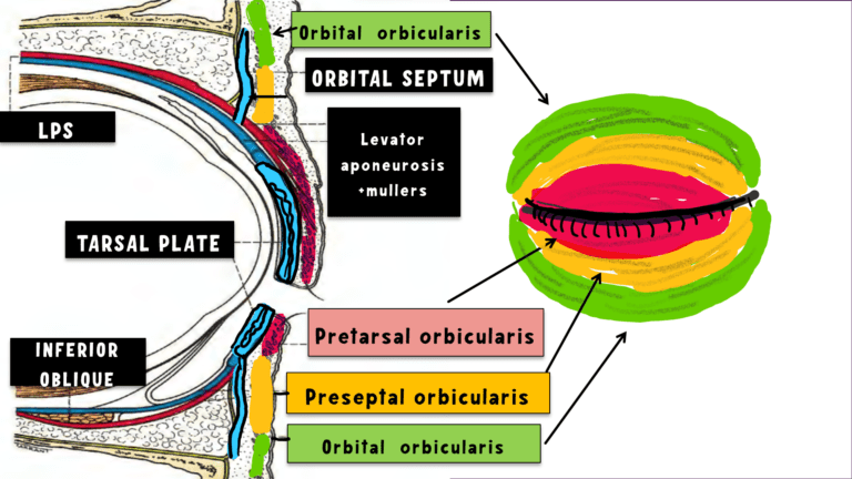 image showing orbital part, pretarsal orbicularis, preseptal orbicularis