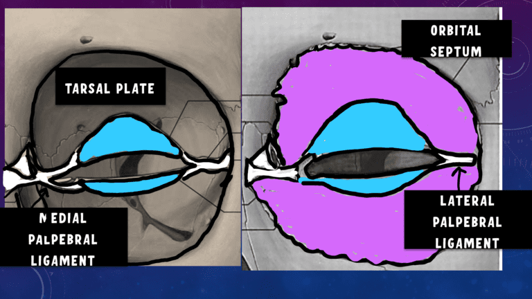 image showing fibrous layer of eyelid , tarsal plate and orbital septum