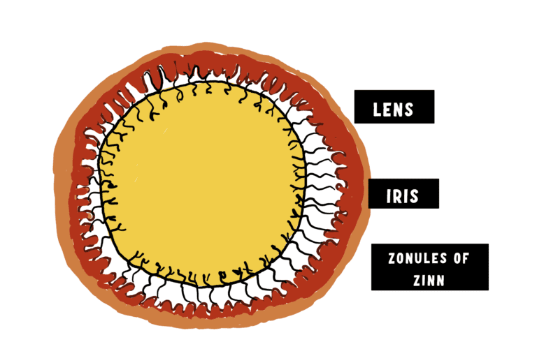 image showing the position of the lens zonules