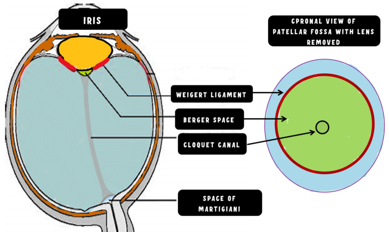 image showing important ligament and spaces around the lens, like weigert liagment, berger space and patellar fossa