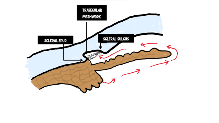 image showing scleral spur, scleral sulcus and trabecular meshwork