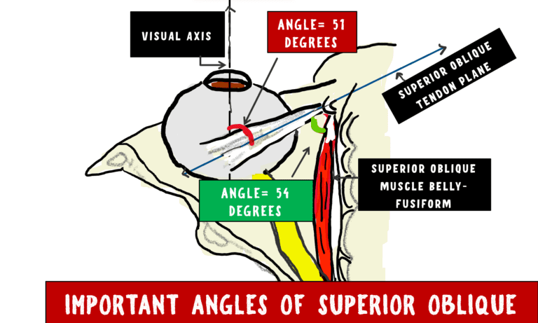 image depicting the insertion of the superior oblique tenson and the important angles it forms with the visual axis.