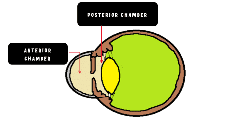 image depicting the anterior chamber and posterior chamber of eye