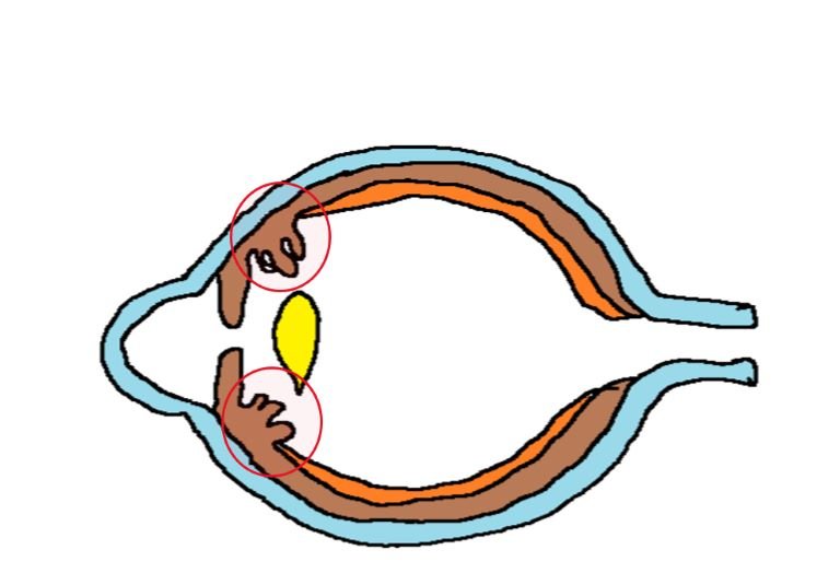diagram depicting the location of ciliary body as a middle part of the uveal tract