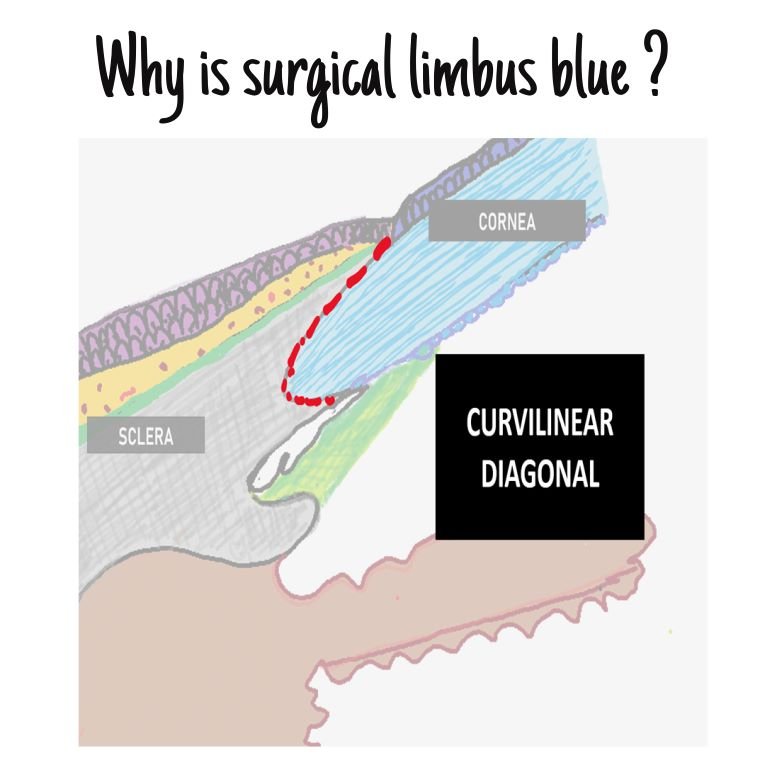 Histological section of limbus curvilinear diagonal