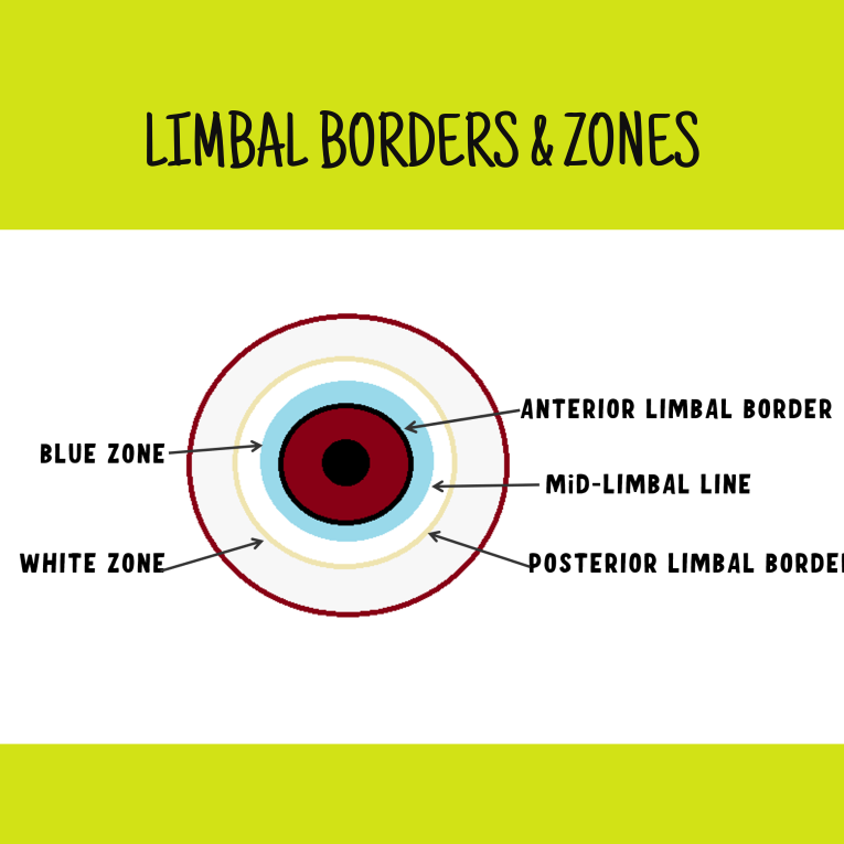 Pictorial representation of limbal landmarks, borders and zones of limbus