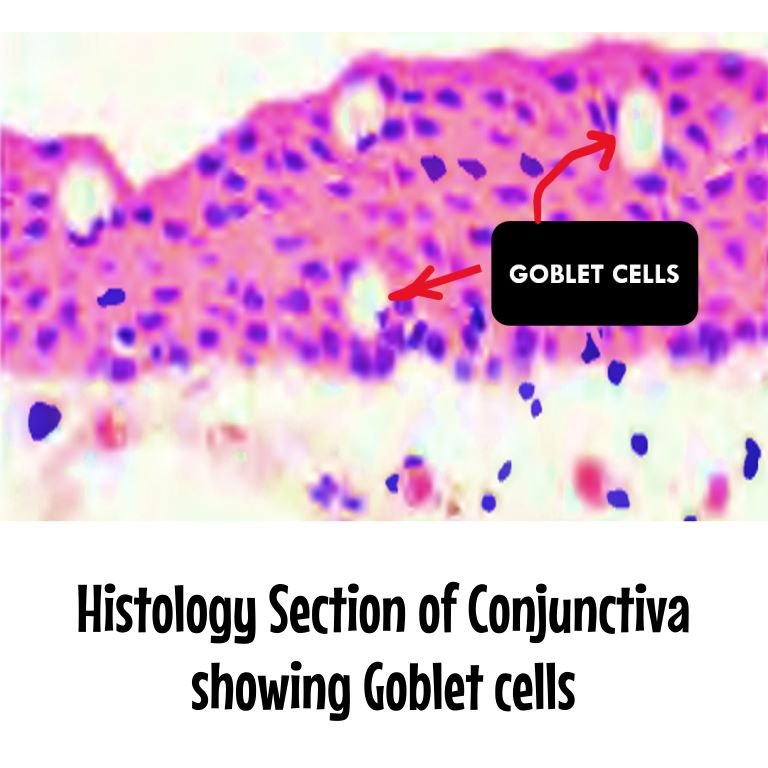 Goblet cells of conjunctiva in epithelium