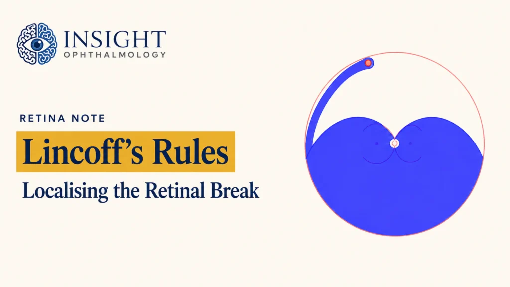 Lincoff rules-featured Image